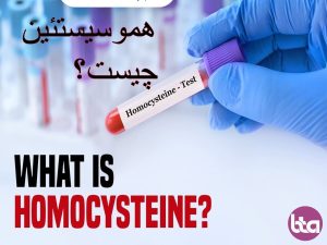 هموسیستئین چیست